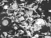 Electron micrographs of diatomaceous earth used for filtration in the chemistry laboratory