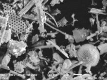 Electron micrographs of diatomaceous earth used for filtration in the chemistry laboratory