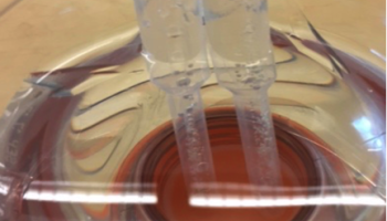 DYI Hoffman Apparatus