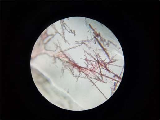 particulate level image of crystal of Ni compound